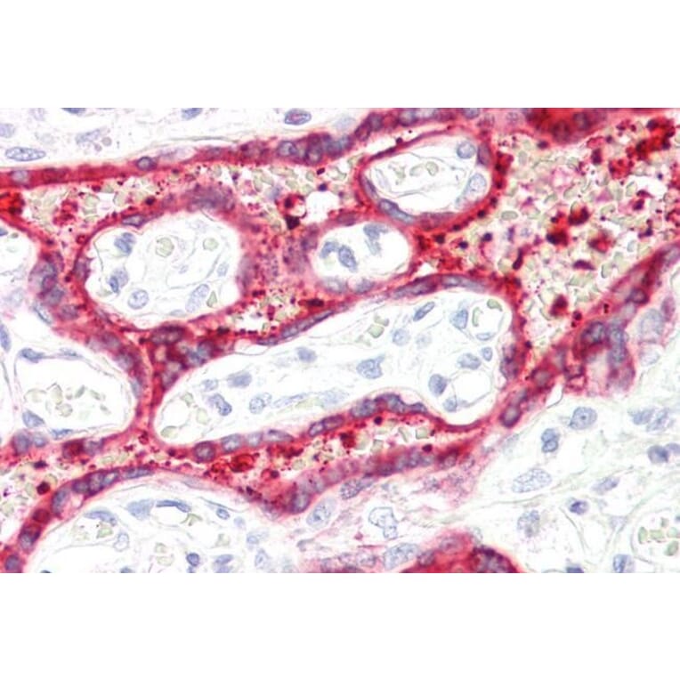 Immunohistochemistry - Anti-HSD3B1 Antibody (A84203) - Antibodies.com
