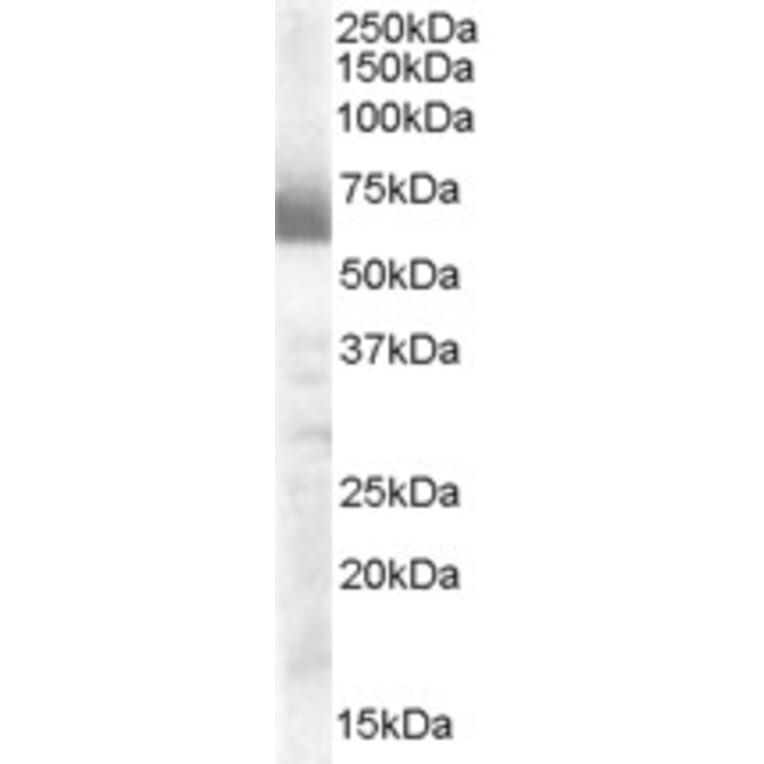 Western Blot - Anti-Cytochrome P450 17A1/CYP17A1 Antibody (A84204) - Antibodies.com