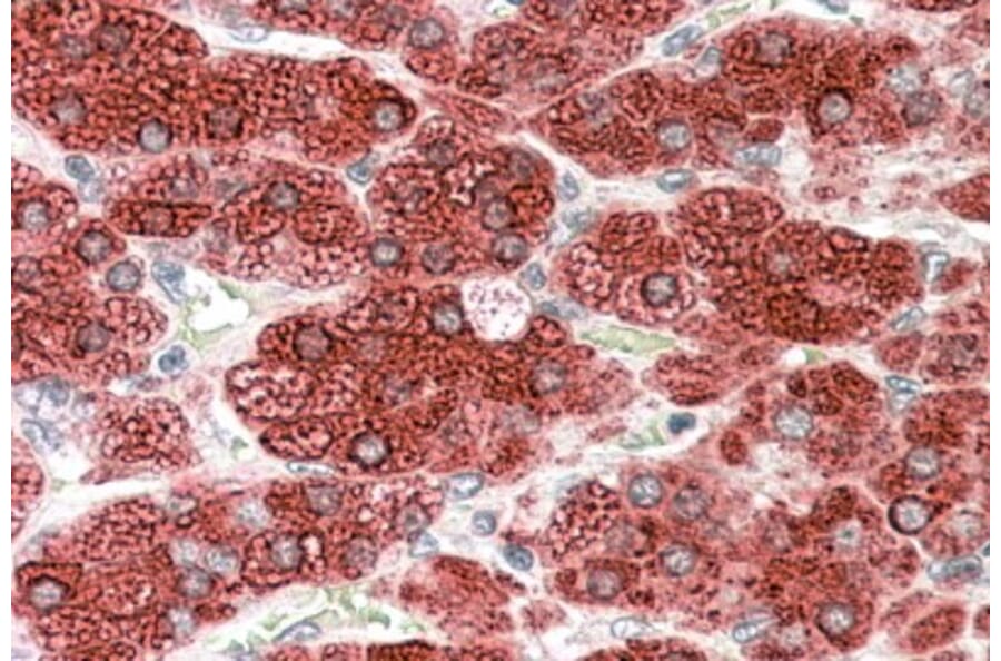 Immunohistochemistry - Anti-Cytochrome P450 17A1/CYP17A1 Antibody (A84204) - Antibodies.com