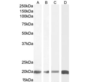 Western Blot - Anti-CNBP Antibody (A84205) - Antibodies.com