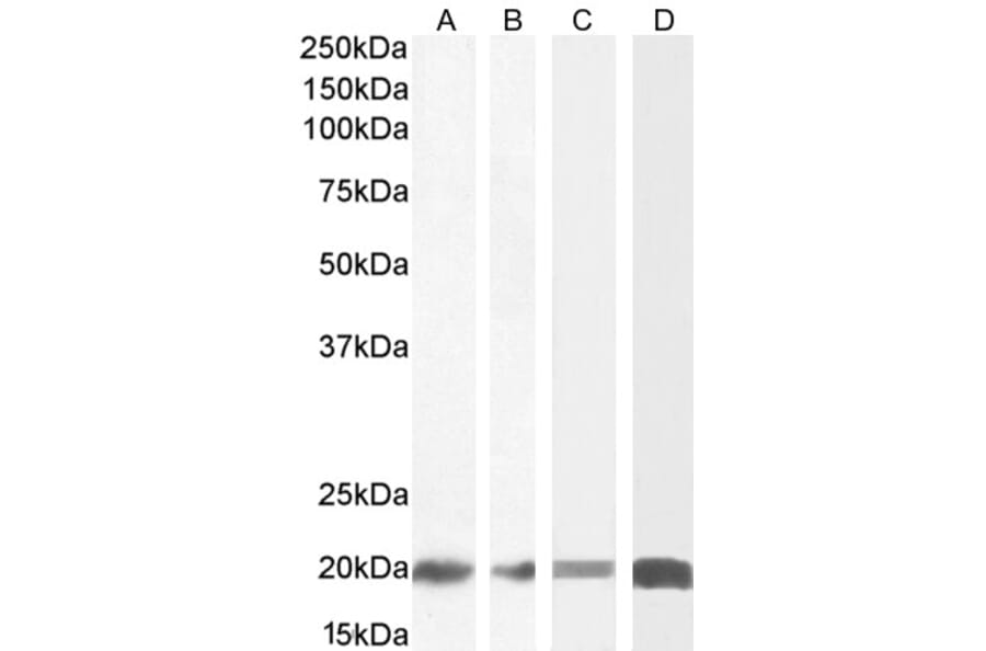Western Blot - Anti-CNBP Antibody (A84205) - Antibodies.com