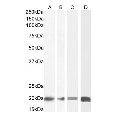 Western Blot - Anti-CNBP Antibody (A84205) - Antibodies.com