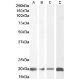 Western Blot - Anti-CNBP Antibody (A84205) - Antibodies.com