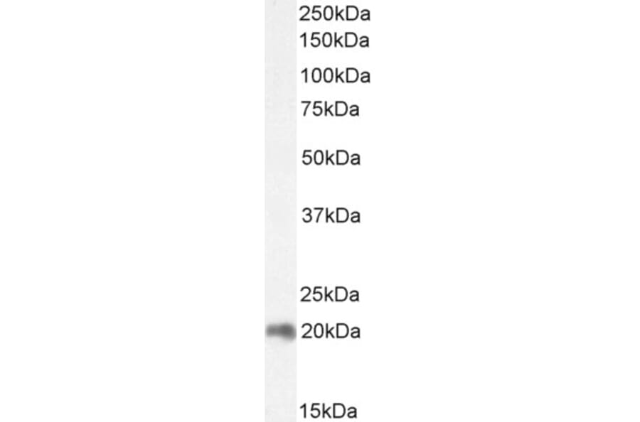 Western Blot - Anti-CNBP Antibody (A84205) - Antibodies.com