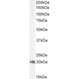 Western Blot - Anti-CNBP Antibody (A84205) - Antibodies.com