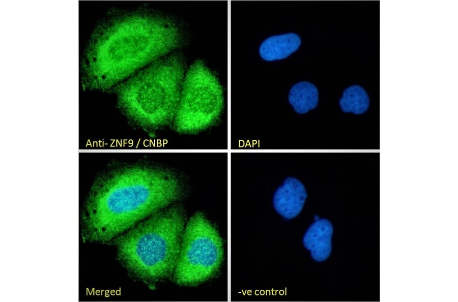 Immunofluorescence - Anti-CNBP Antibody (A84205) - Antibodies.com