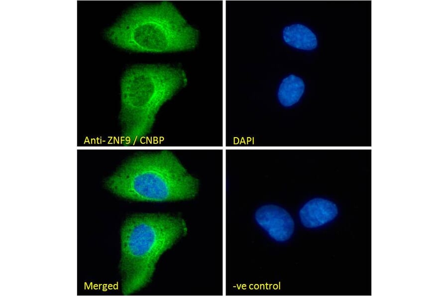 Immunofluorescence - Anti-CNBP Antibody (A84205) - Antibodies.com