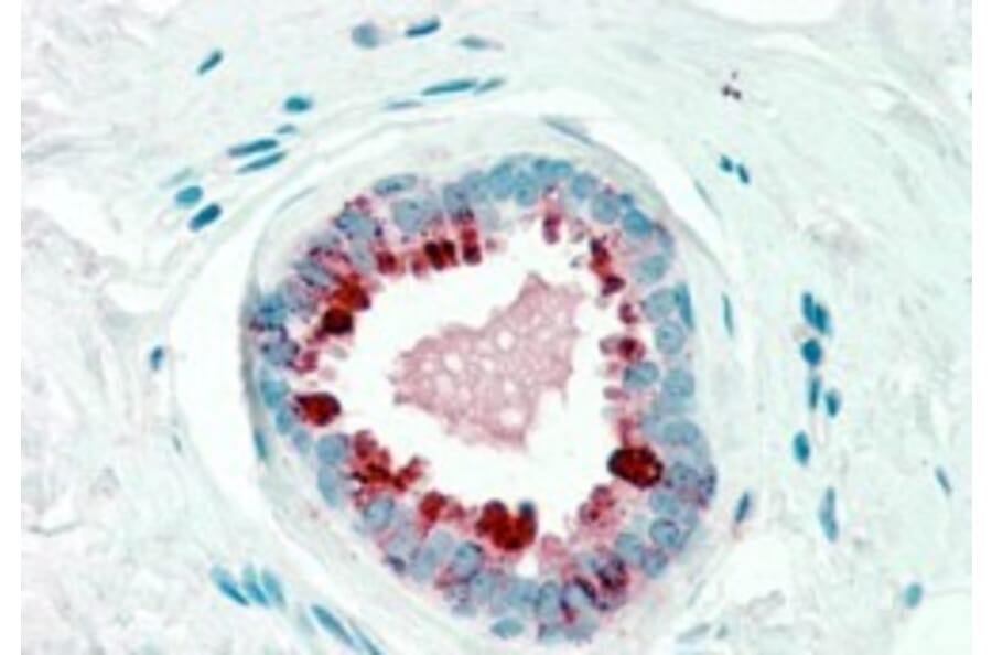 Immunohistochemistry - Anti-GCDFP 15 Antibody (A84206) - Antibodies.com