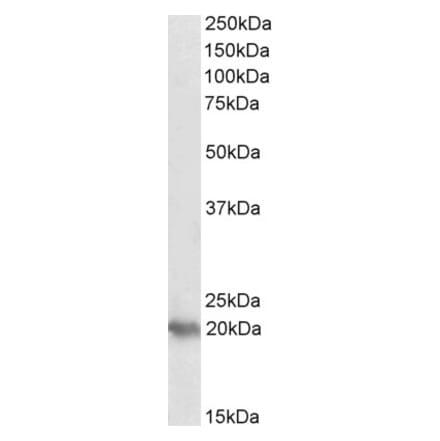 Western Blot - Anti-PERP Antibody (A84207) - Antibodies.com