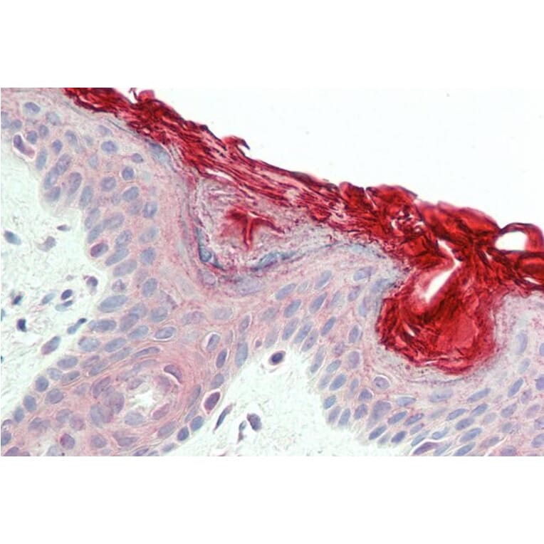 Immunohistochemistry - Anti-PERP Antibody (A84207) - Antibodies.com