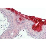 Immunohistochemistry - Anti-PERP Antibody (A84207) - Antibodies.com