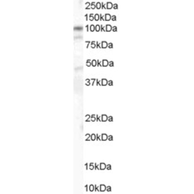 Western Blot - Anti-CTNNA1 Antibody (A84208) - Antibodies.com