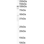Western Blot - Anti-CTNNA1 Antibody (A84208) - Antibodies.com