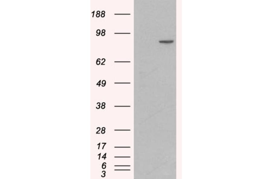 Western Blot - Anti-CTNNA1 Antibody (A84208) - Antibodies.com