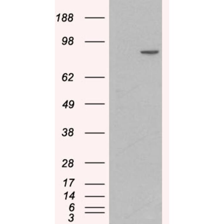 Western Blot - Anti-CTNNA1 Antibody (A84208) - Antibodies.com