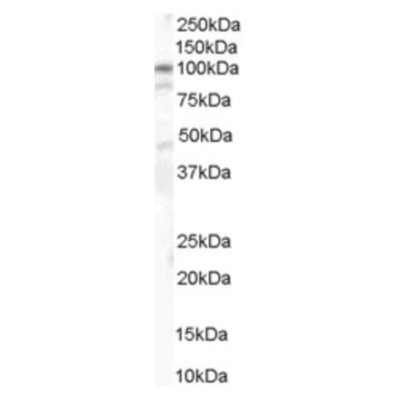 Western Blot - Anti-CTNNA1 Antibody (A84208) - Antibodies.com