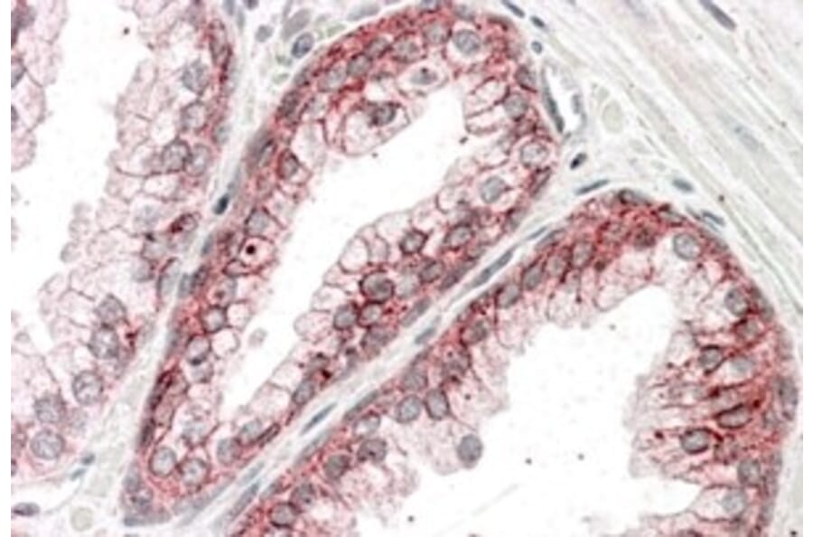 Immunohistochemistry - Anti-CTNNA1 Antibody (A84208) - Antibodies.com