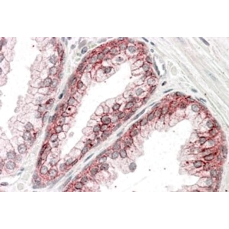 Immunohistochemistry - Anti-CTNNA1 Antibody (A84208) - Antibodies.com