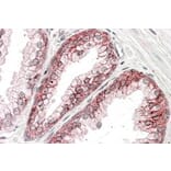 Immunohistochemistry - Anti-CTNNA1 Antibody (A84208) - Antibodies.com