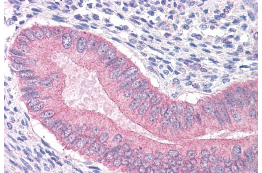 Immunohistochemistry - Anti-CTNNA1 Antibody (A84208) - Antibodies.com