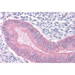 Immunohistochemistry - Anti-CTNNA1 Antibody (A84208) - Antibodies.com