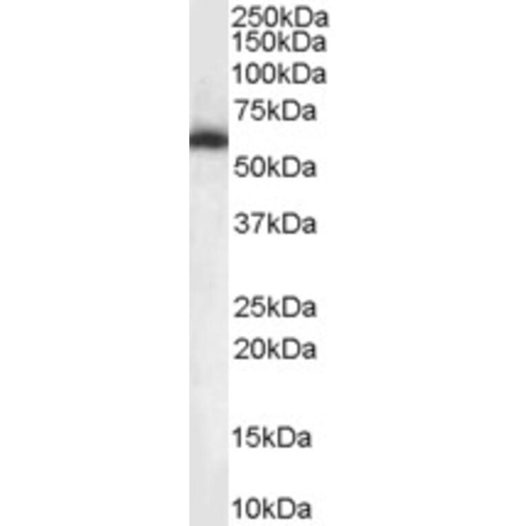 Western Blot - Anti-nmt55/p54nrb Antibody (A84209) - Antibodies.com