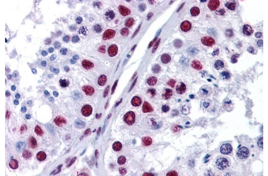 Immunohistochemistry - Anti-nmt55/p54nrb Antibody (A84209) - Antibodies.com