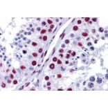 Immunohistochemistry - Anti-nmt55/p54nrb Antibody (A84209) - Antibodies.com