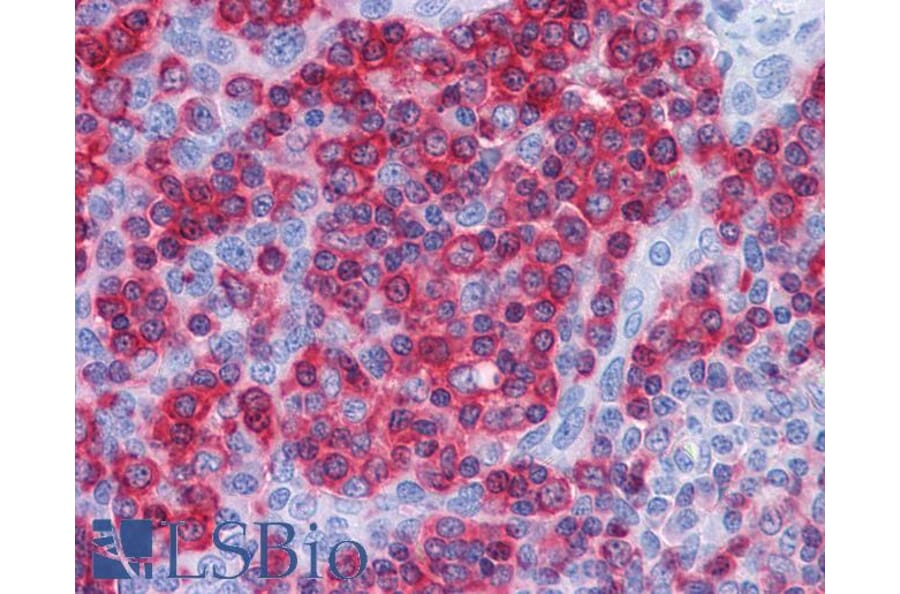 Immunohistochemistry - Anti-Prolyl Endopeptidase Antibody (A84212) - Antibodies.com