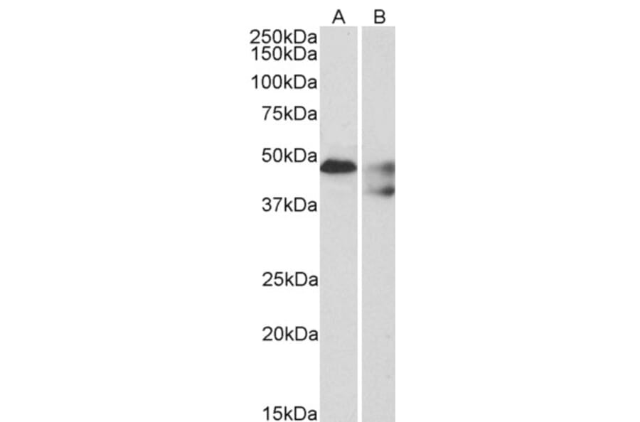 Western Blot - Anti-5HT1B Receptor Antibody (A84214) - Antibodies.com