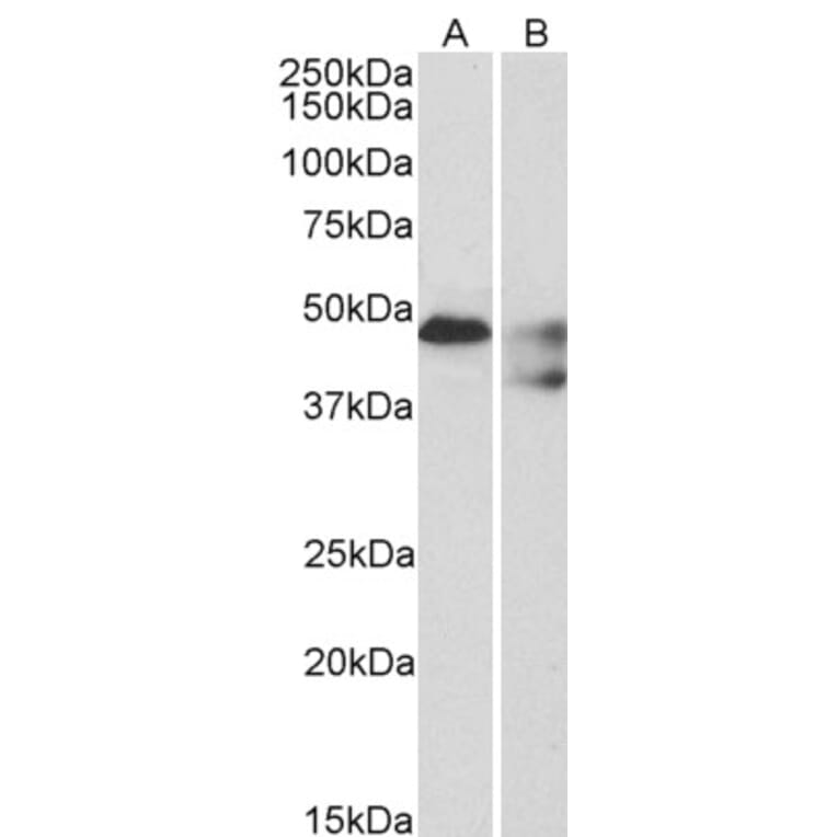 Western Blot - Anti-5HT1B Receptor Antibody (A84214) - Antibodies.com