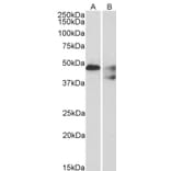 Western Blot - Anti-5HT1B Receptor Antibody (A84214) - Antibodies.com