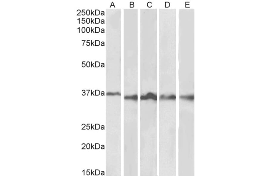 Western Blot - Anti-Aurora B Antibody (A84215) - Antibodies.com