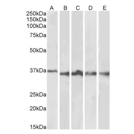 Western Blot - Anti-Aurora B Antibody (A84215) - Antibodies.com
