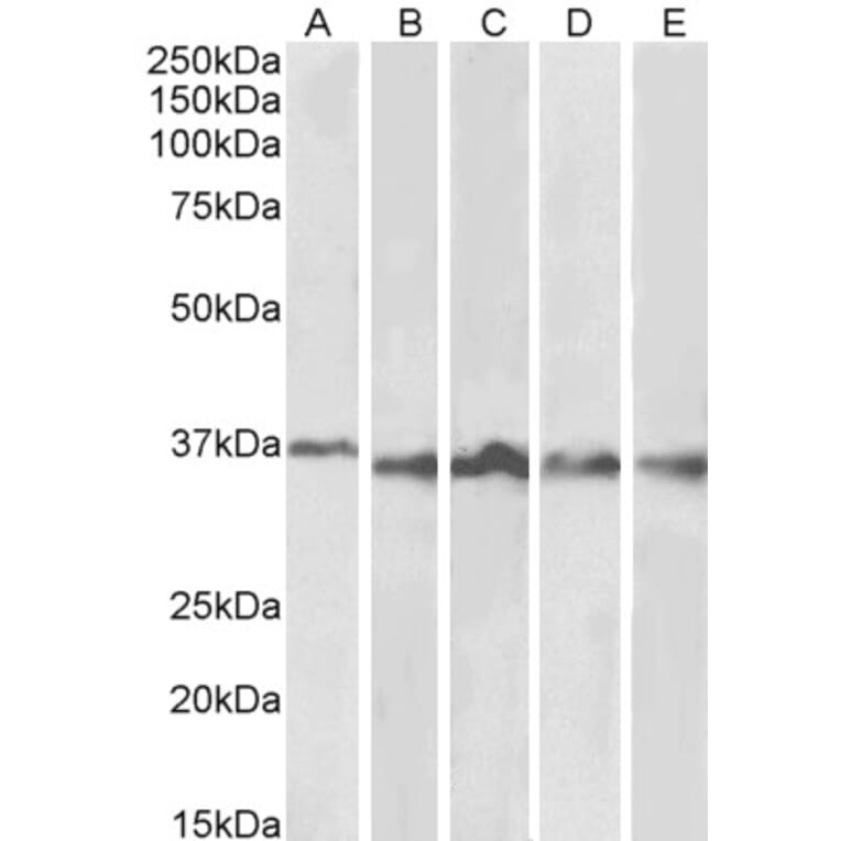 Western Blot - Anti-Aurora B Antibody (A84215) - Antibodies.com