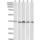 Western Blot - Anti-Aurora B Antibody (A84215) - Antibodies.com