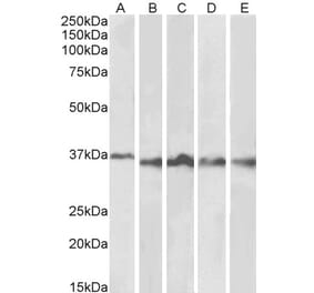 Western Blot - Anti-AURKB Antibody (A84215) - Antibodies.com