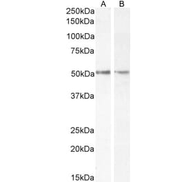 Western Blot - Anti-Chromogranin A Antibody (A84217) - Antibodies.com