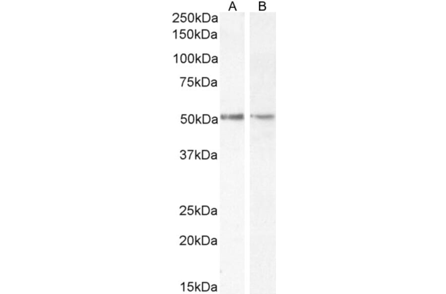 Western Blot - Anti-Chromogranin A Antibody (A84217) - Antibodies.com