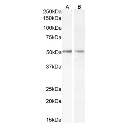 Western Blot - Anti-Chromogranin A Antibody (A84217) - Antibodies.com