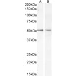 Western Blot - Anti-Chromogranin A Antibody (A84217) - Antibodies.com