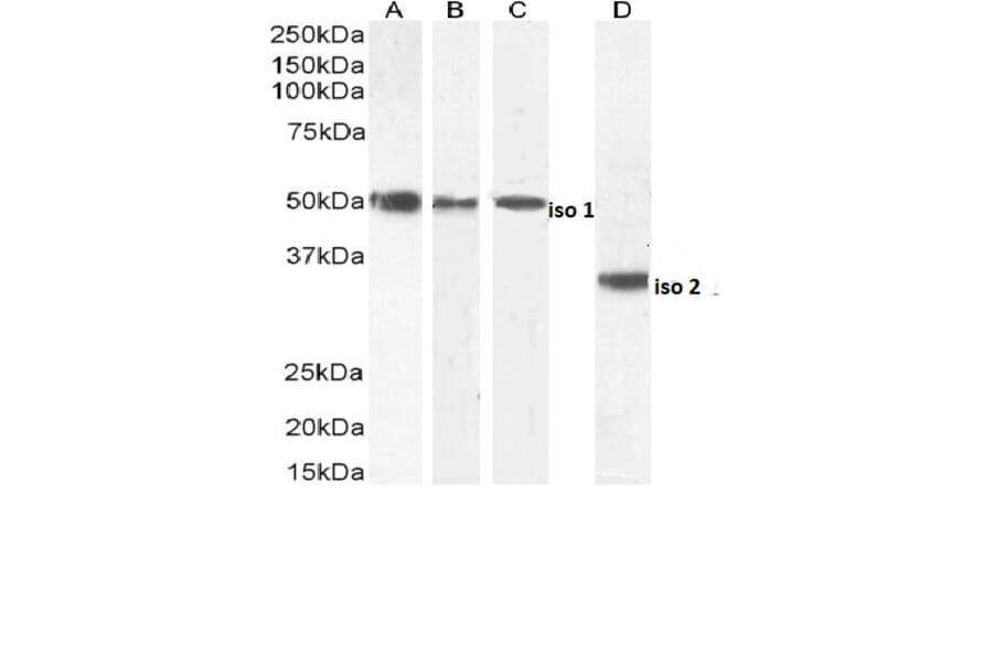 Western Blot - Anti-Chromogranin A Antibody (A84217) - Antibodies.com