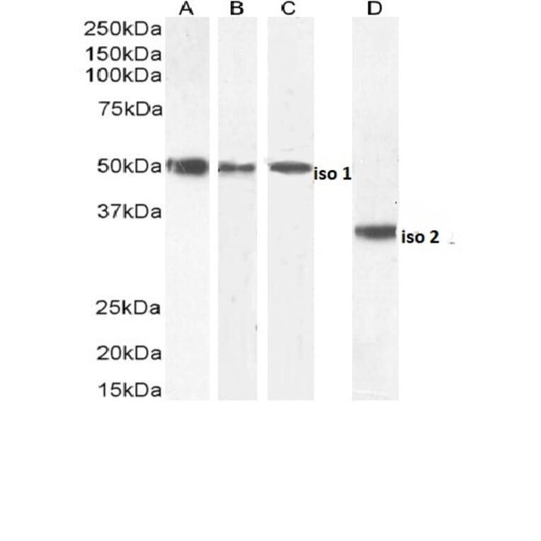 Western Blot - Anti-Chromogranin A Antibody (A84217) - Antibodies.com