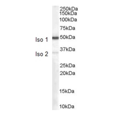 Western Blot - Anti-CHGA Antibody (A84217)