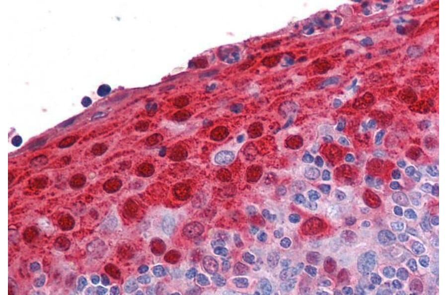 Immunohistochemistry - Anti-S100A7 Antibody (A84218) - Antibodies.com