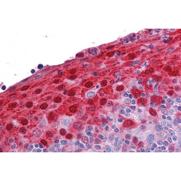 Immunohistochemistry - Anti-S100A7 Antibody (A84218) - Antibodies.com