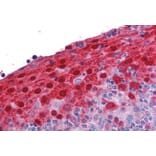 Immunohistochemistry - Anti-S100A7 Antibody (A84218) - Antibodies.com