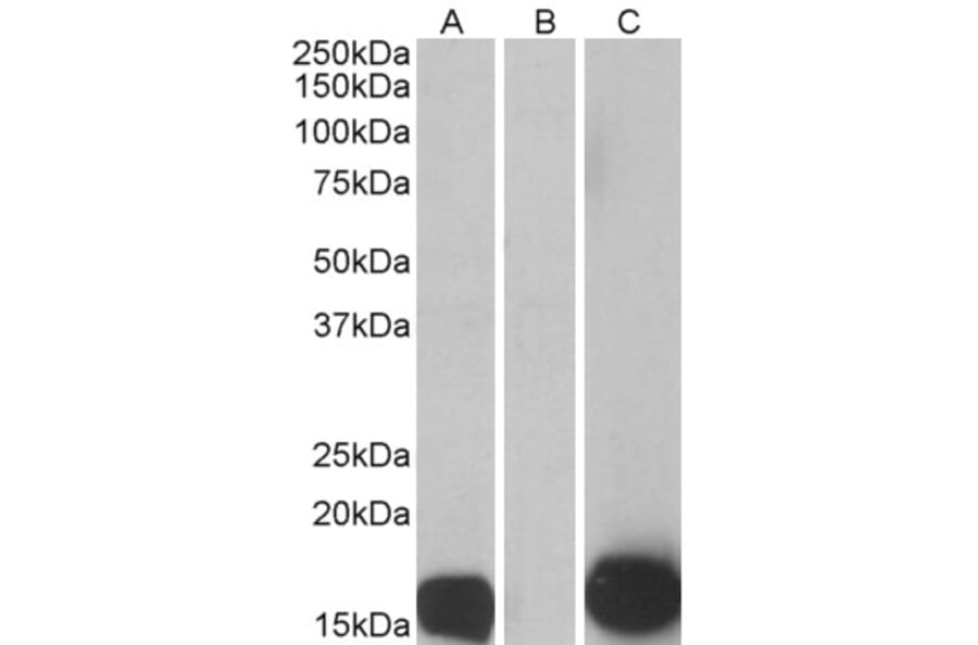 Western Blot - Anti-S100A7 Antibody (A84218) - Antibodies.com