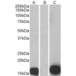 Western Blot - Anti-S100A7 Antibody (A84218) - Antibodies.com