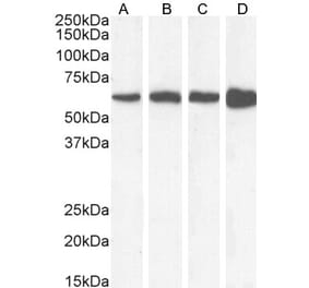 Western Blot - Anti-Catalase Antibody (A84220) - Antibodies.com